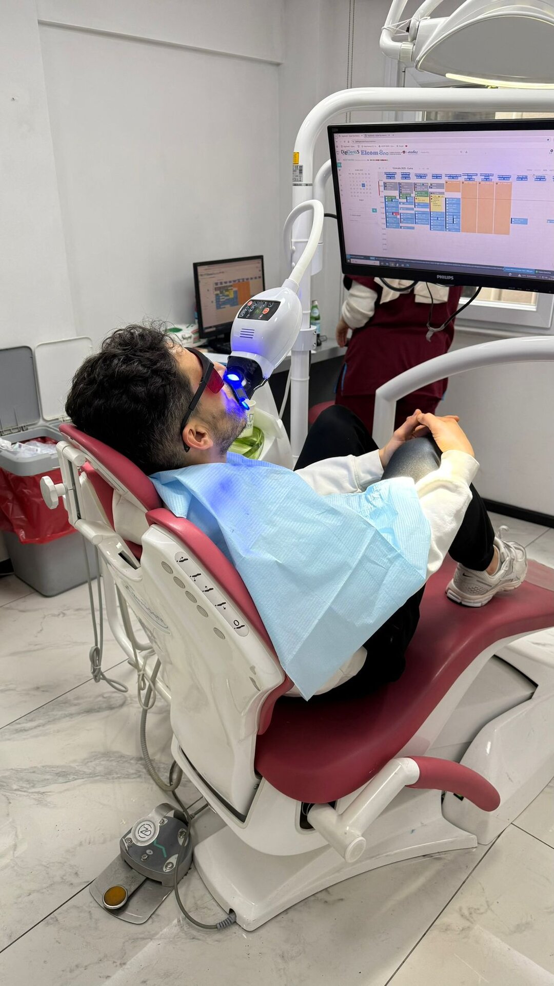 Hollywood Smile Results