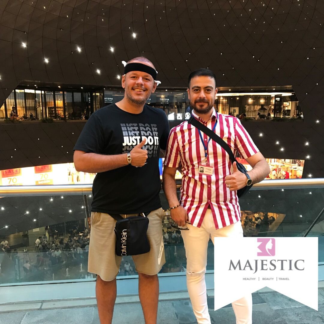 Hair Transplant Result