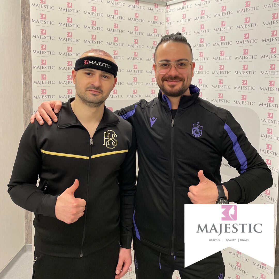 Hair Transplant Result