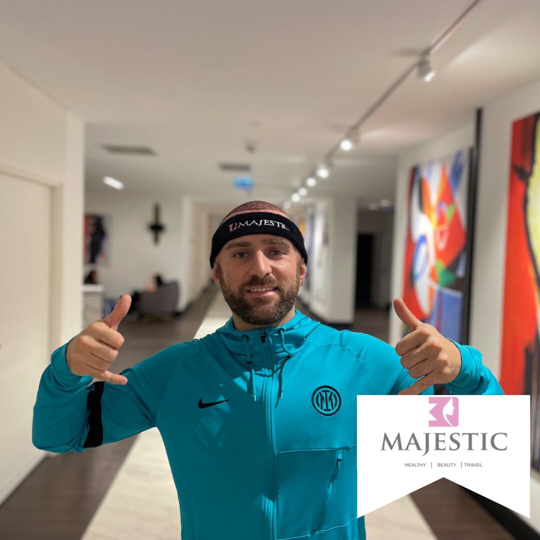 Hair Transplant Result